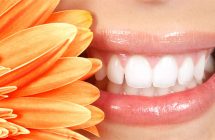 Estética dental.