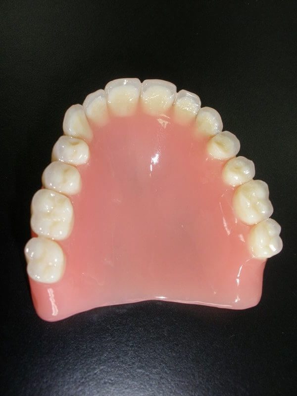 Prótesis completa superior (dentadura de la parte de arriba).