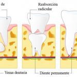 Situación de los dientes permanentes debajo de los dientes de leche.