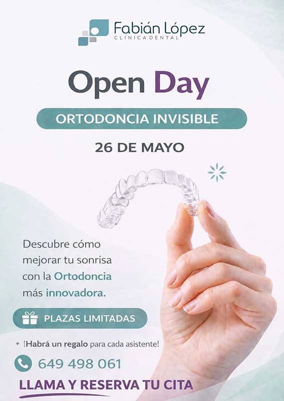 open-day