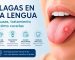 llagas en la lengua
